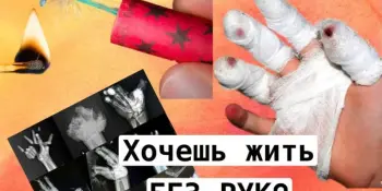 Картинка маслом, или кто ответит за пальцы?